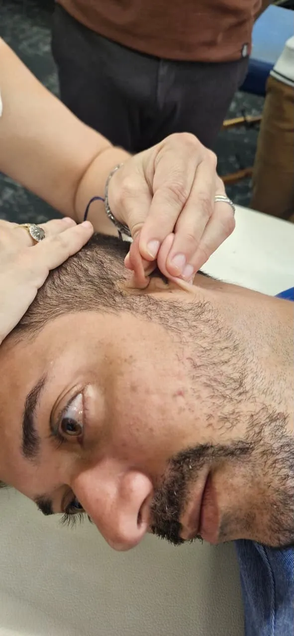Zumbido Somatossensorial para Fisioterapeutas
